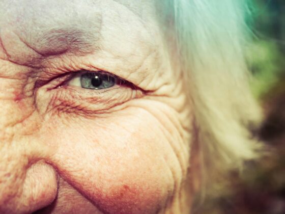 Close-up of an elderly person's eye and surrounding wrinkled skin, showing blue-gray iris and fine facial lines.